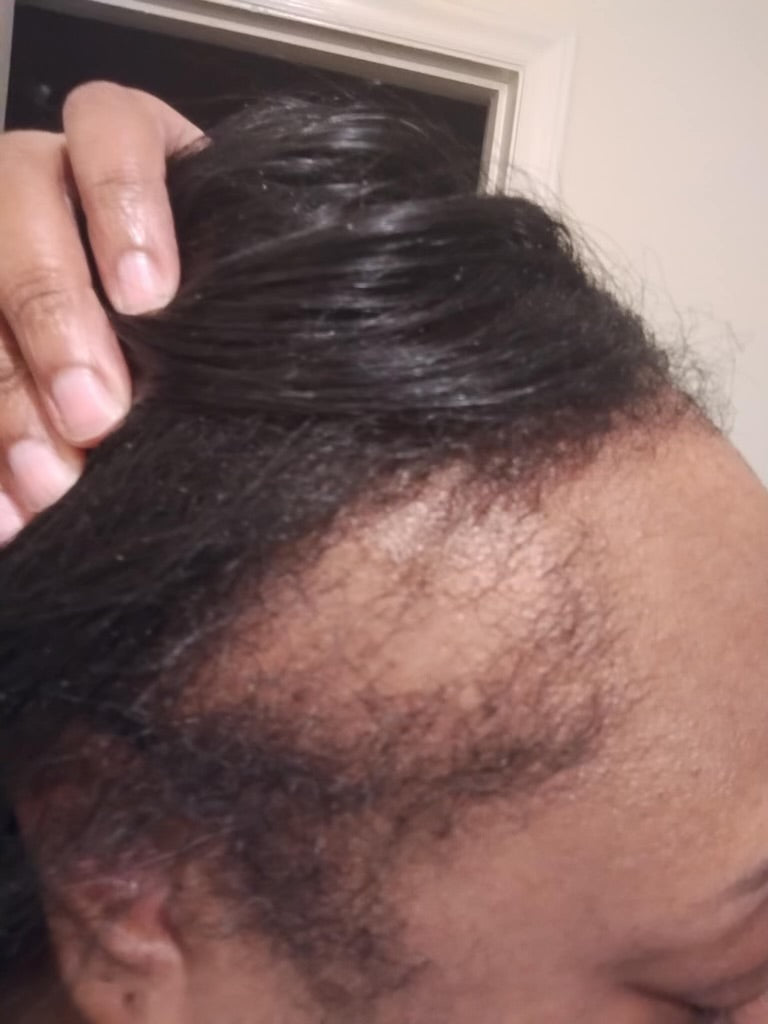 Extra strength hair oil🌱